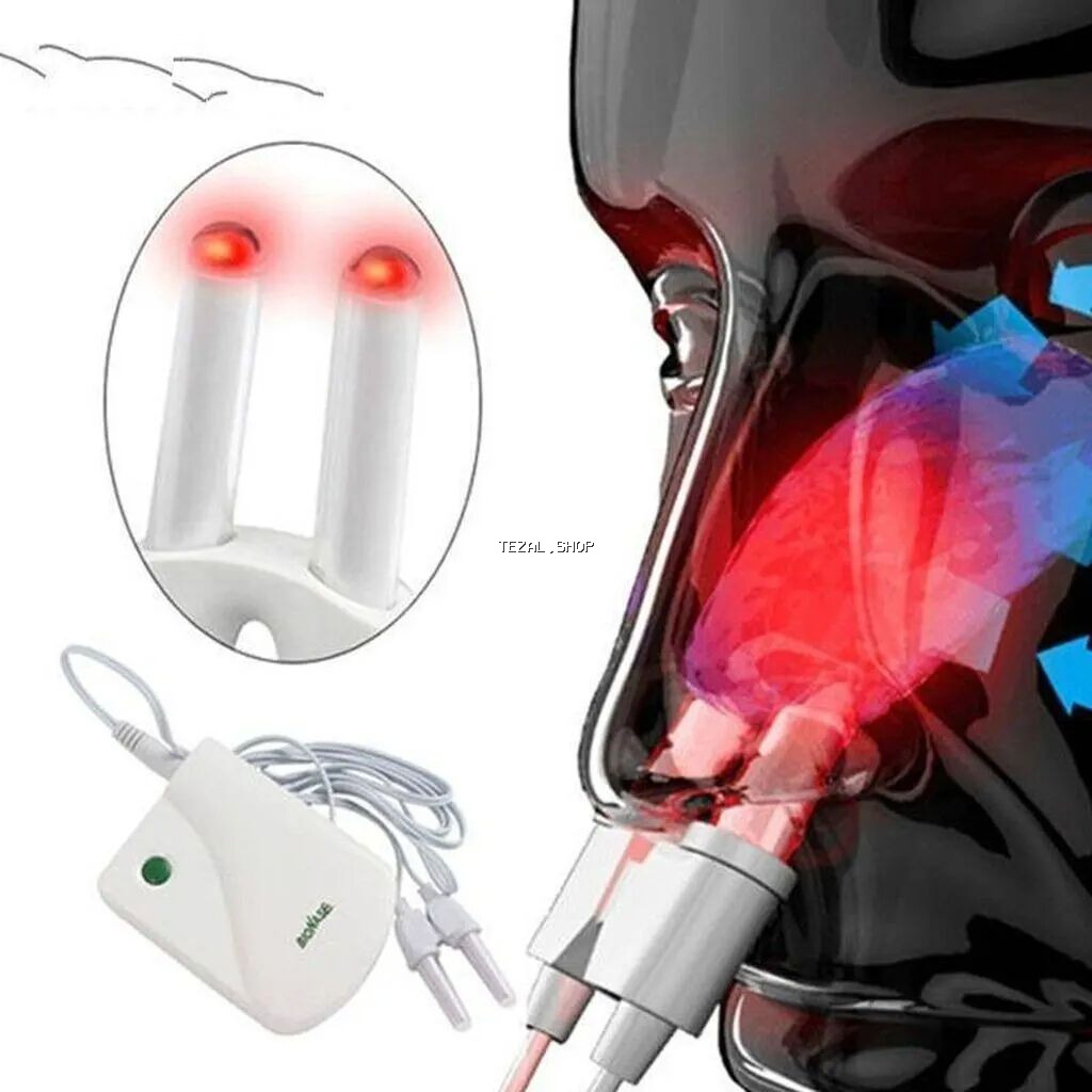 Burun üçün lazer müalicəsi cihazı Rinit,sinusit xəstəlikləri zamanı