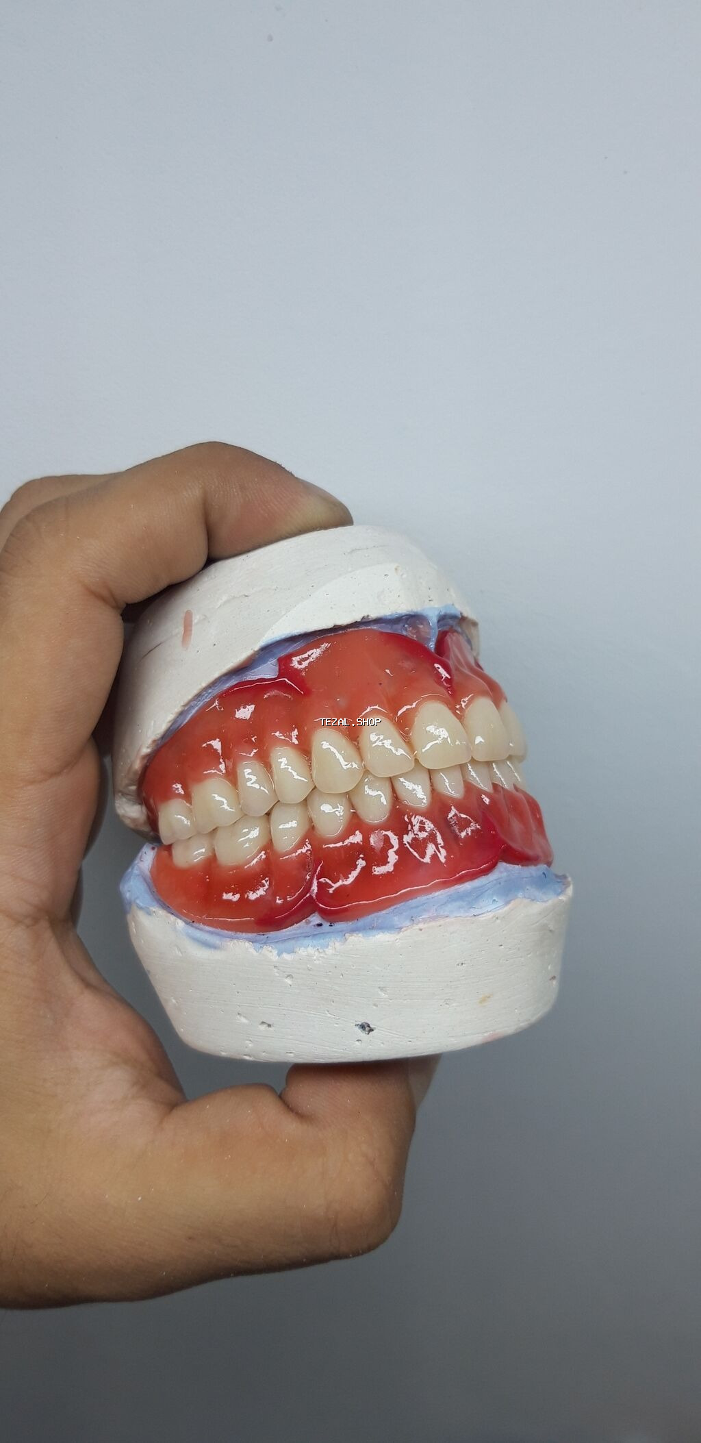 Her növ total protezlərin hazırlanması bir başa paciente - şəkil 3