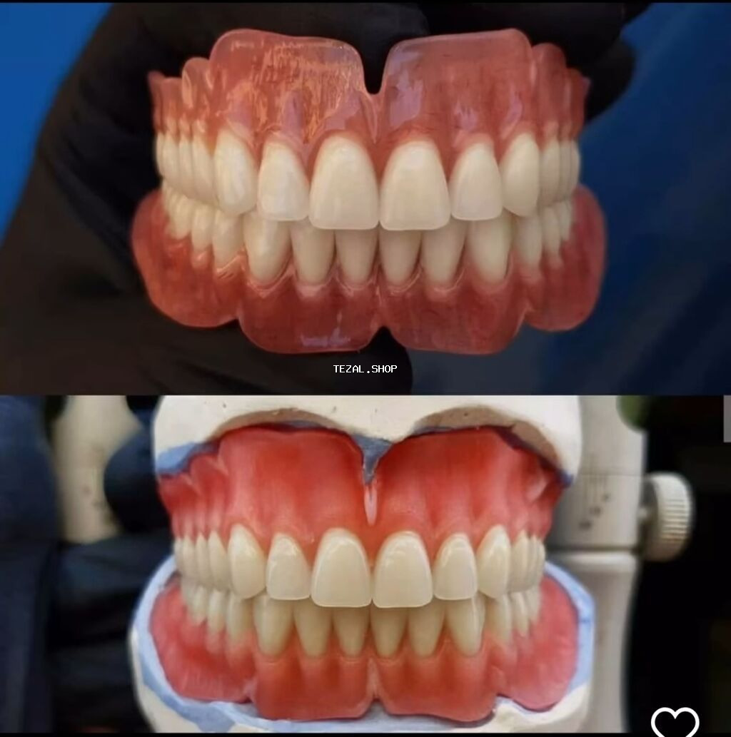 Her növ total protezlərin hazırlanması bir başa paciente - şəkil 4