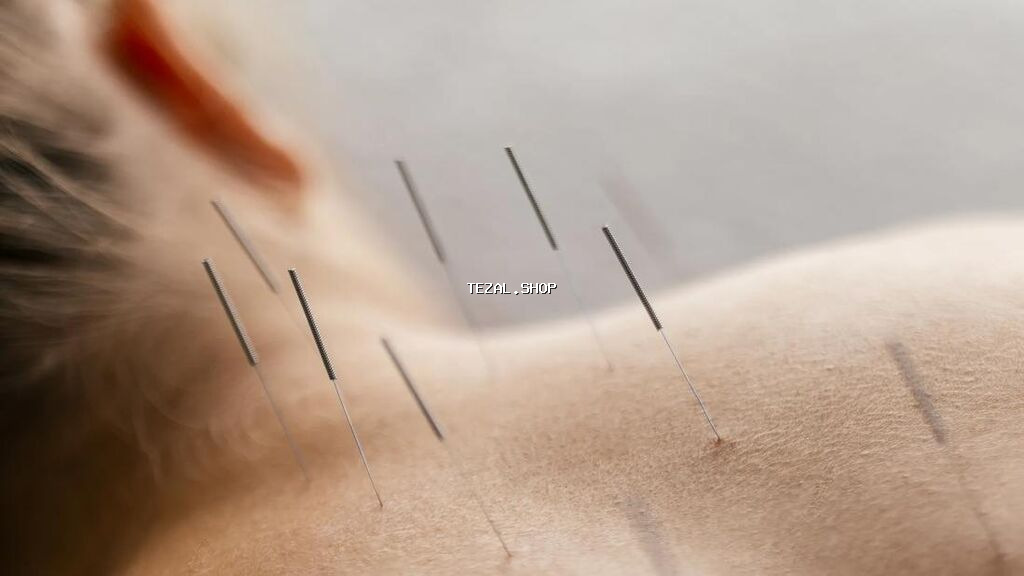 Akupunktur iynələri
Akapunktur iynəsi satışı