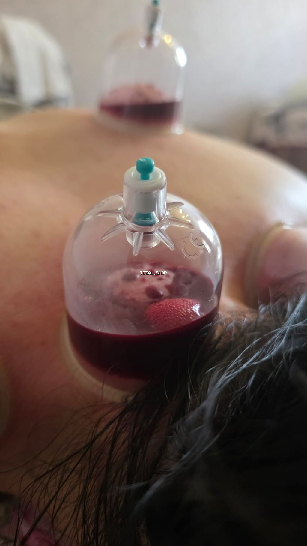 ### **🏠 Evdə Peşəkar Tibbi Xidmət (Böyüklər və Uşaqlar üçün)** - şəkil 3