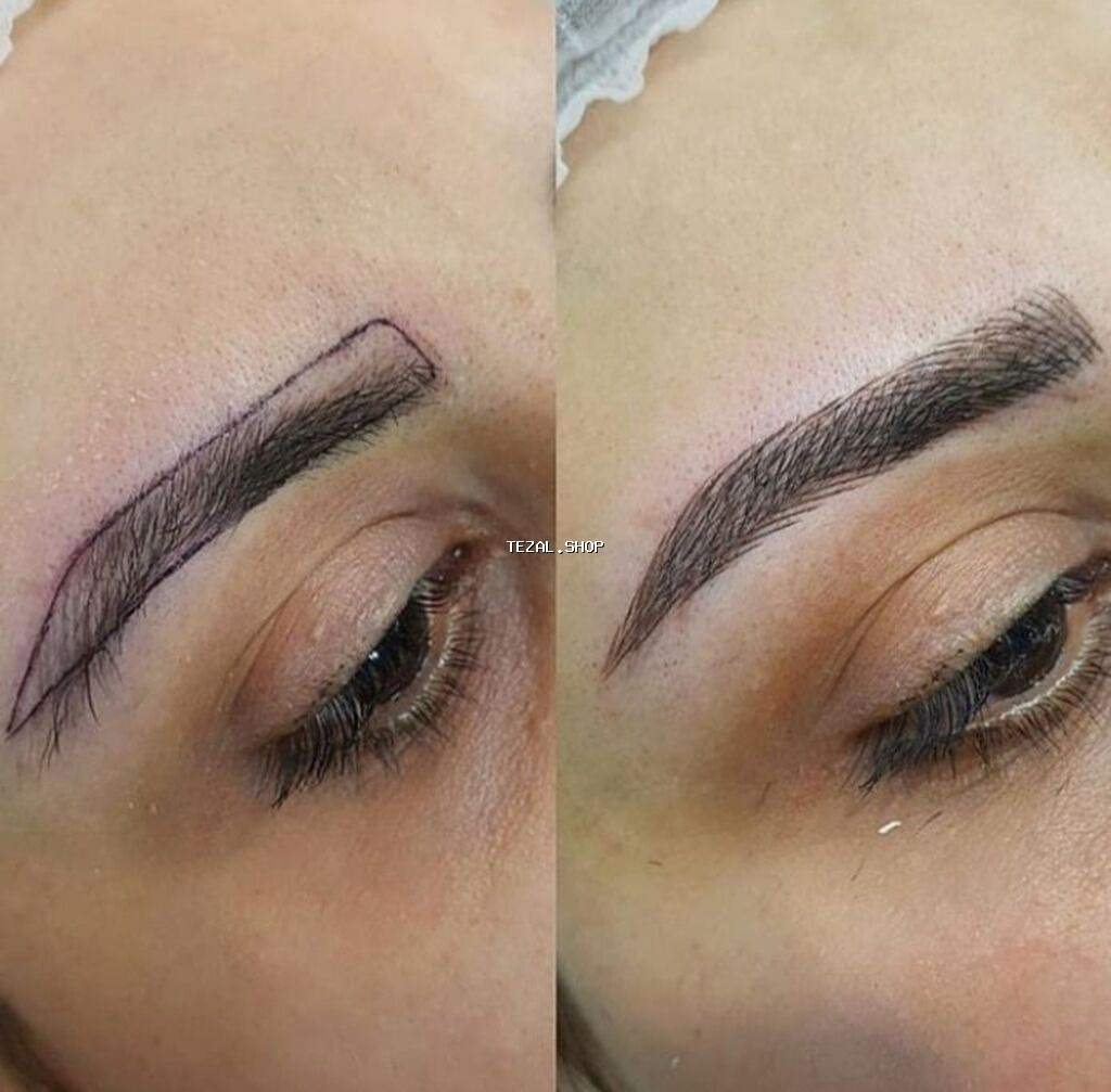 Seyrek formasiz qaslarin mikrobledinqle berpasi - şəkil 2