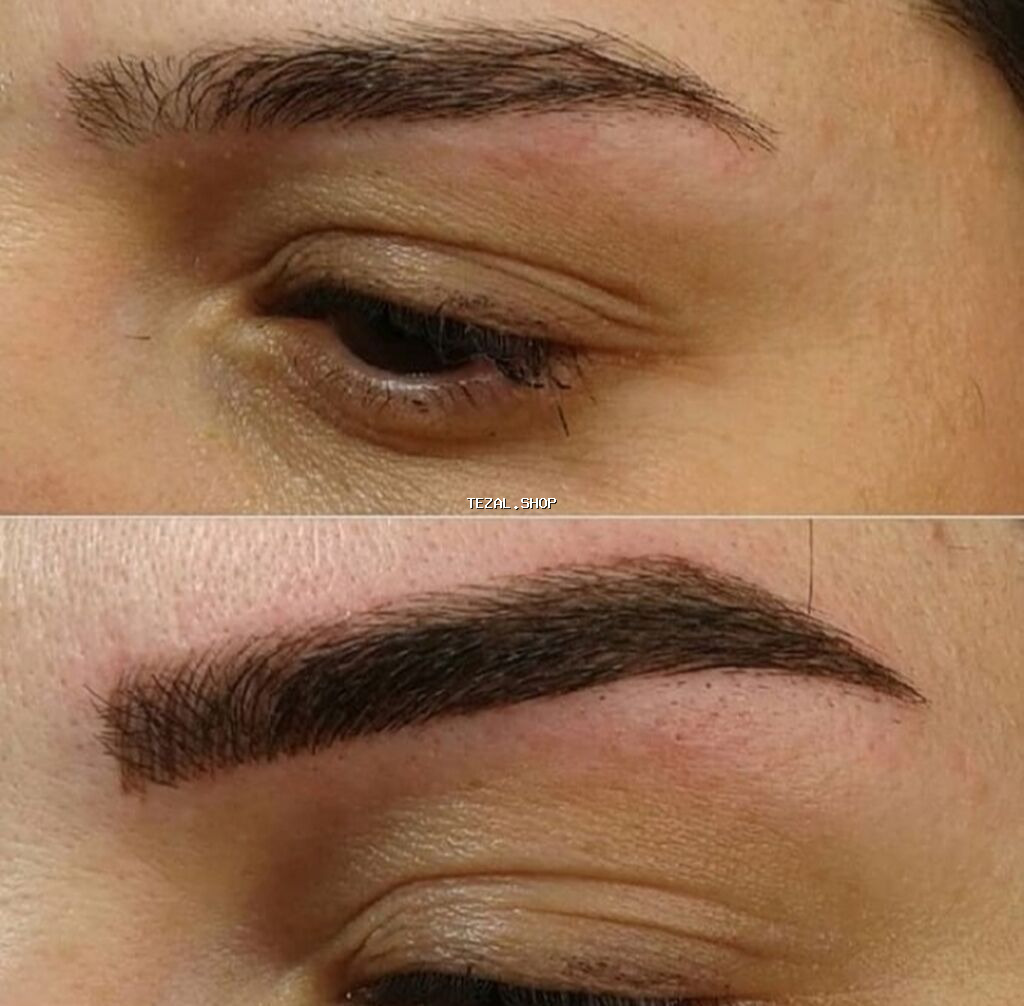 Seyrek formasiz qaslarin mikrobledinqle berpasi - şəkil 3