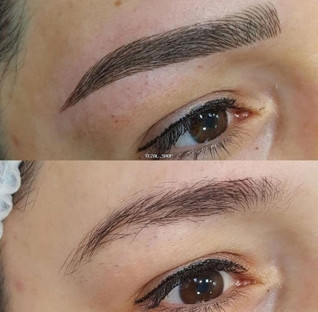 Seyrek formasiz qaslarin mikrobledinqle berpasi - şəkil 4