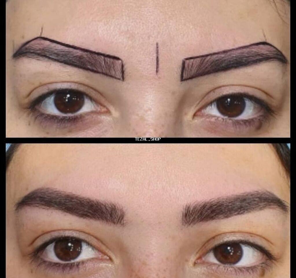 Seyrek formasiz qaslarin mikrobledinqle berpasi - şəkil 5