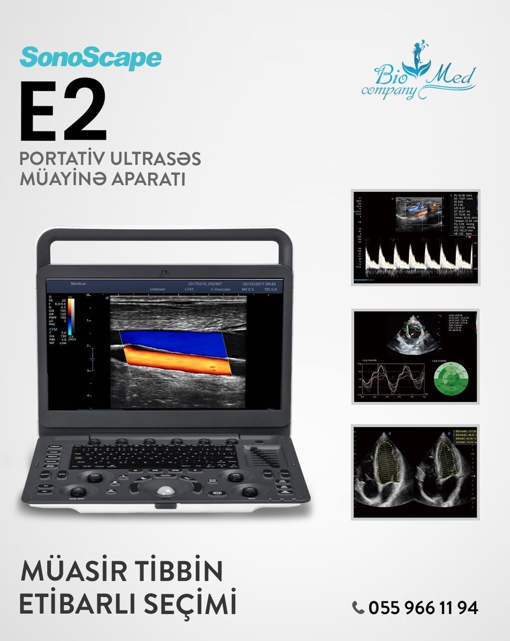 SonoScape E2: Tam Komplekt, Peşəkar Diaqnostika! Klinikanızın