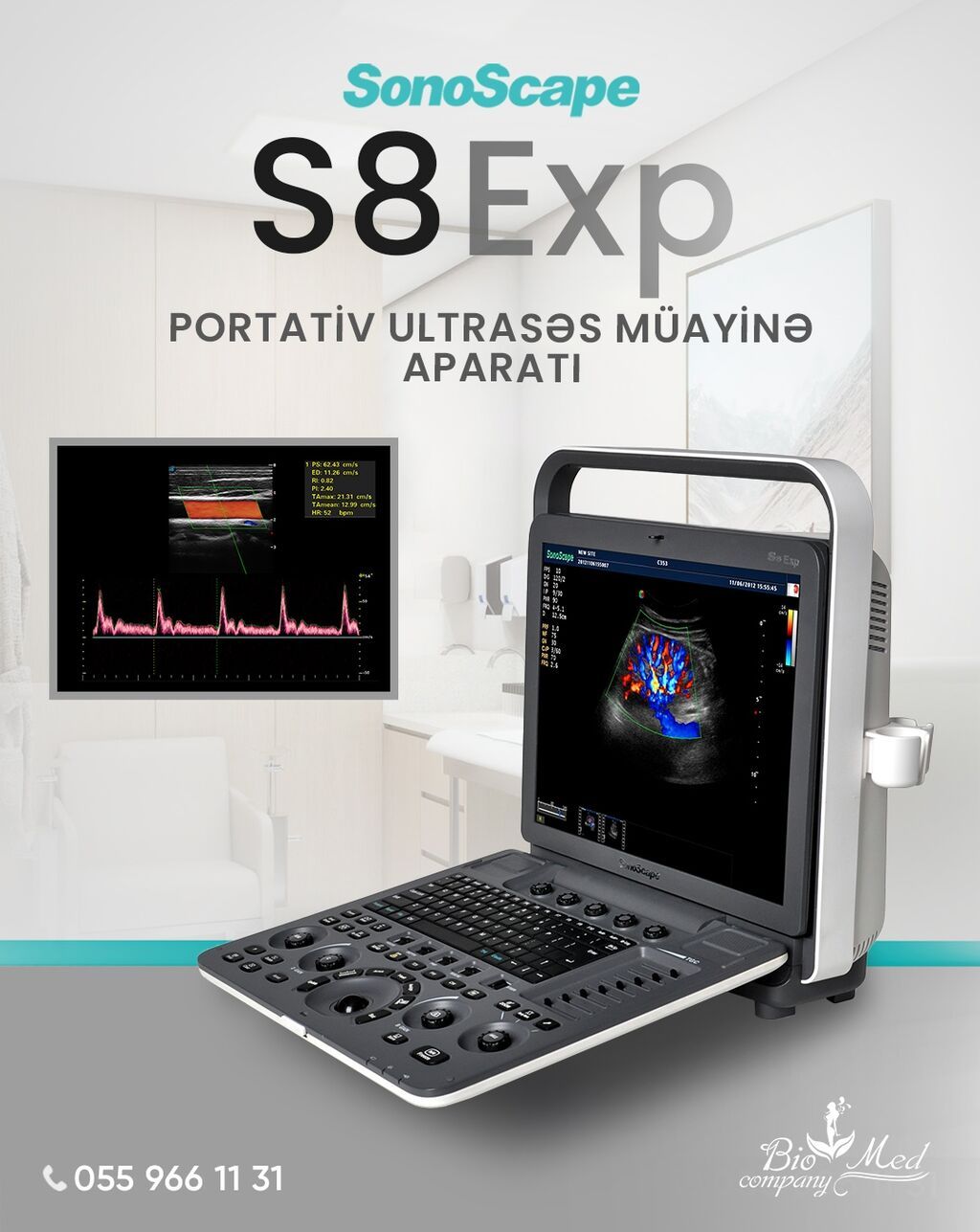 SonoScape S8 Expert: Portativ Dizaynda Stasionar Gücü! Diaqnostikada