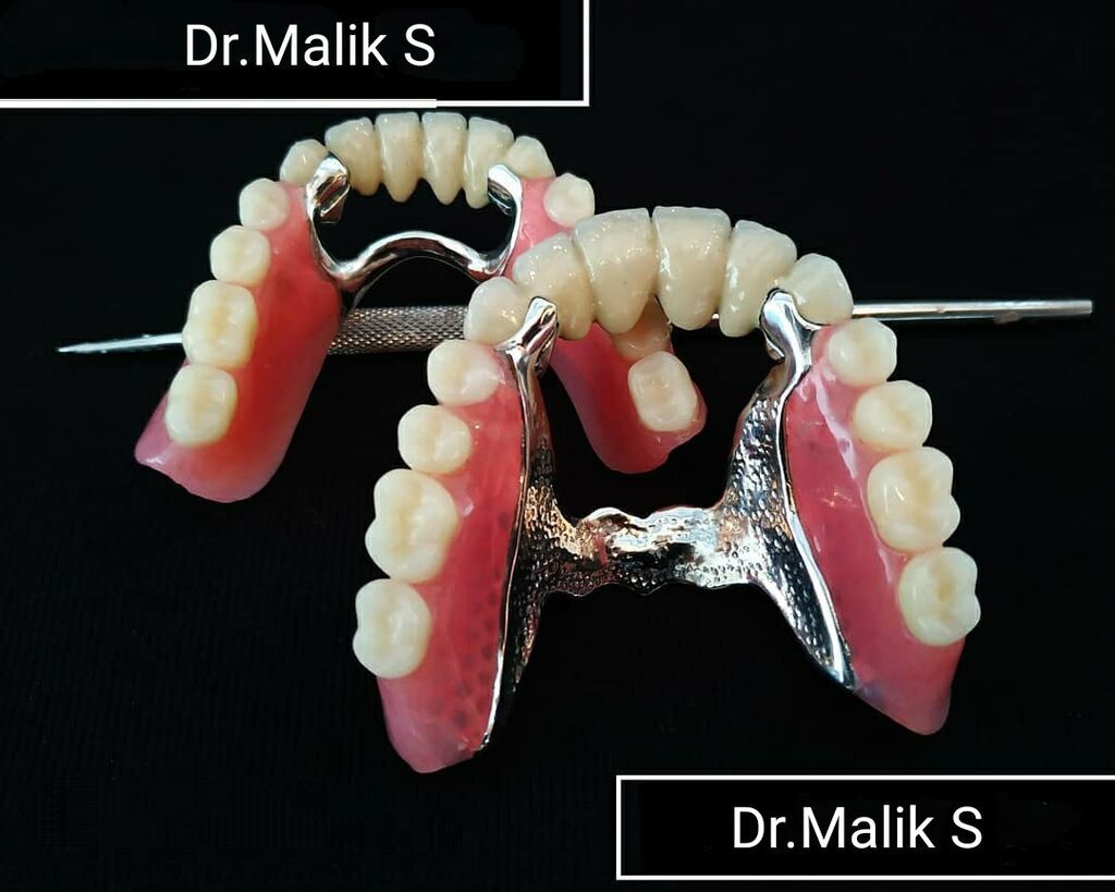 Protezlerin yenilenmesi Pasientlərimizə rahat və allergik olmayan