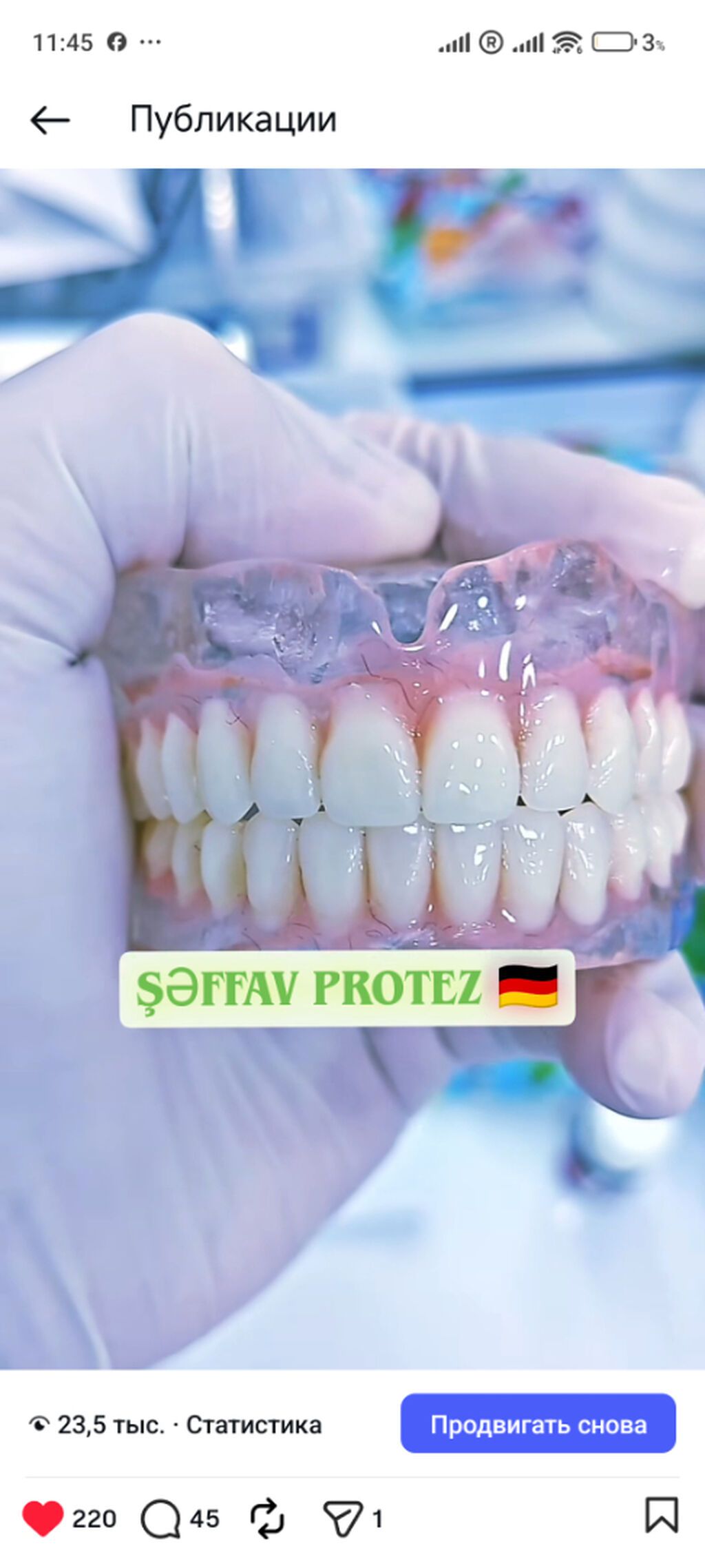 Bizimlə əlaqə saxlayın Whatsap 📲 +994-70-755-57-70 Protezlerin