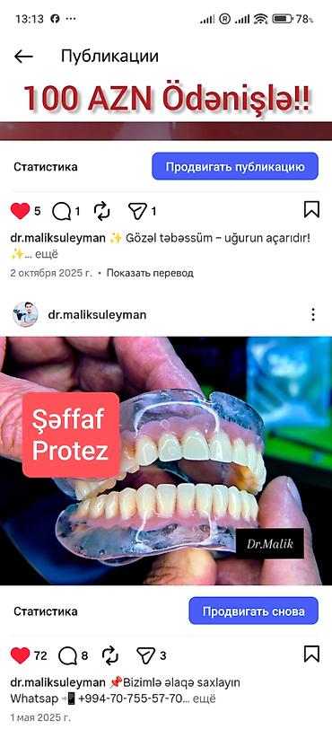 İndi Daha Rahat və Estetik 💠 Qiymətlər Estetik plomb (1 diş) – 50₼ - şəkil 5