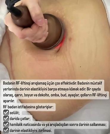 Müalicəvi masaj, Uşaqlar üçün, Kişilər üçün, Qadınlar üçün, Klinikada - şəkil 4
