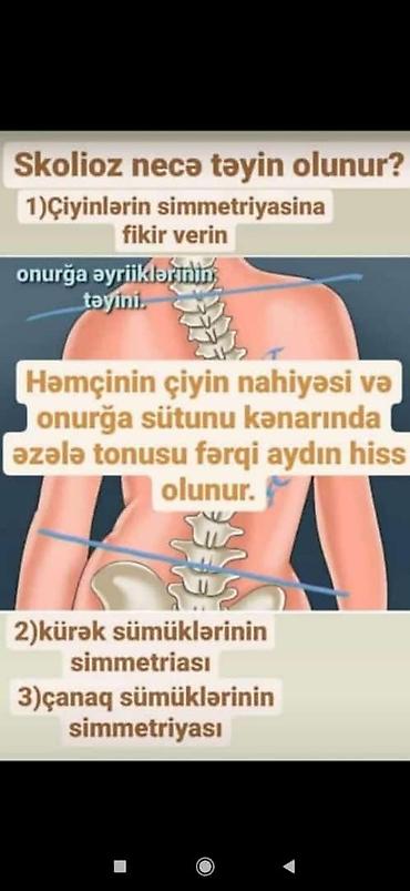 Skolioz masajı, Uşaqlar üçün - şəkil 3