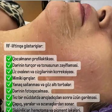 Müalicəvi masaj, Uşaqlar üçün, Kişilər üçün, Qadınlar üçün, Klinikada - şəkil 2