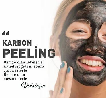 Tecili!!! Satilir ve ya arendaya veri̇li̇r .Kredi̇tle 8000 i̇lk - şəkil 2