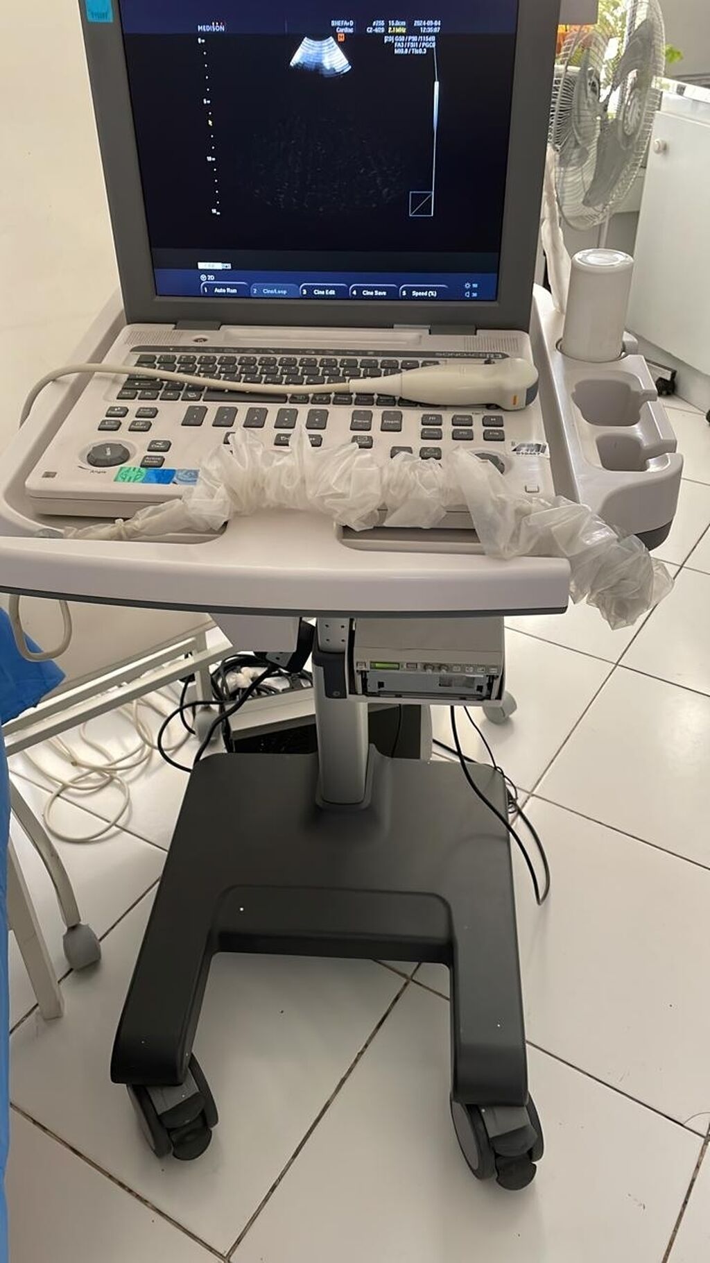 USM aparati satilir. Renglidir. Dopler edir. 4 dacciklidi. 2011 ci